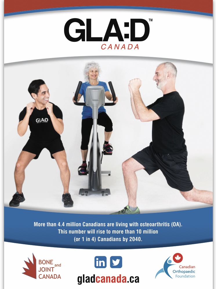 Osteoarthritis? No problem! City Sports & Physiotherapy Clinic